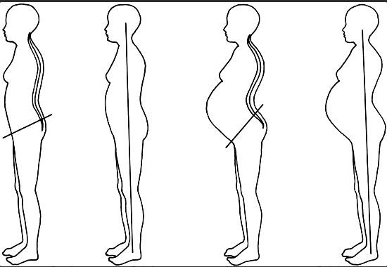 postural